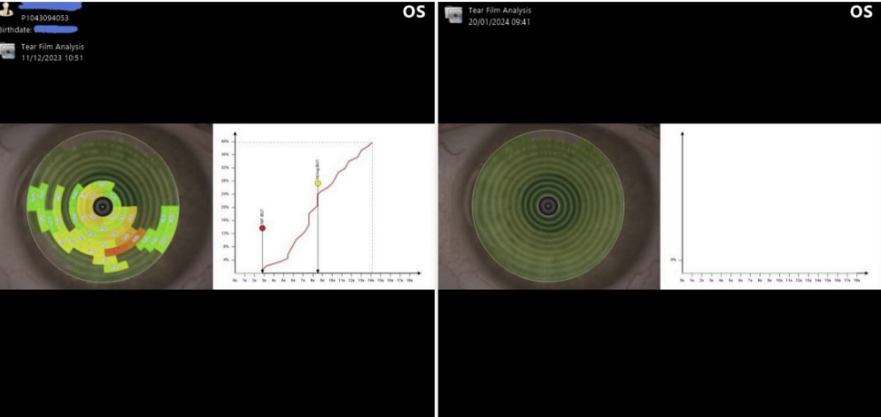 julias story tear break up